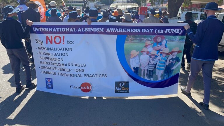 Netone join Albinism Charity Organization in commemorating International Albinism Day