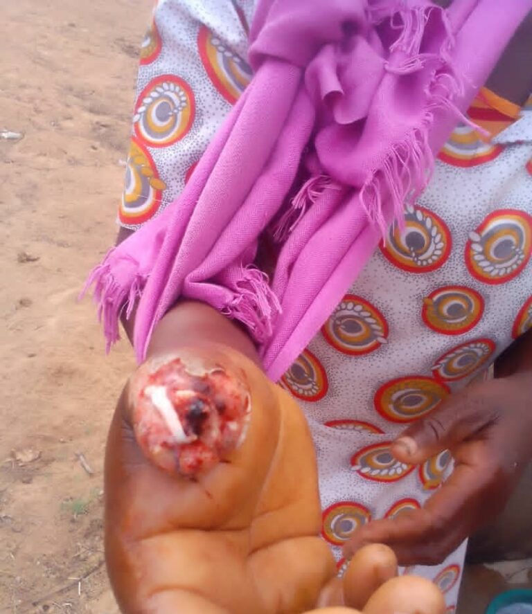 Donkey bites, swallows Bikita woman’s finger