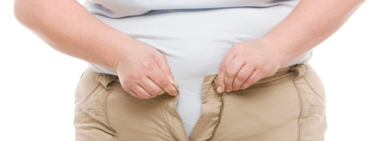 Nearly half of Zim adult population overweight and obese